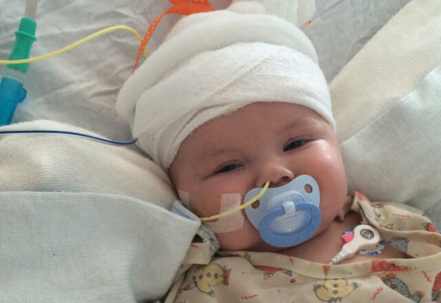 Adelynn, after her Chiari malformation surgery