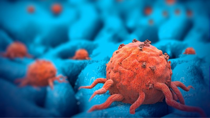 El extraño caso de la curación de un linfoma de Hodgkin por el SARS-CoV-2