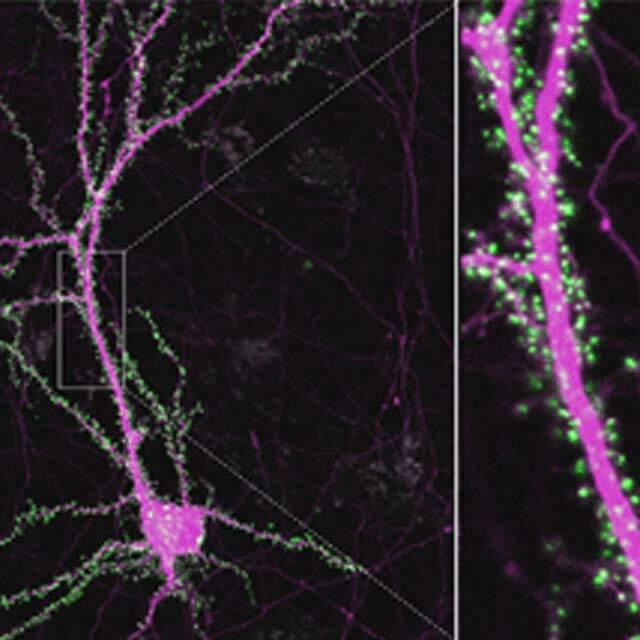 Literal Window into Mouse Brain Lets Researchers Observe Minute Changes