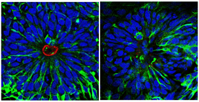Neural stem cell rosettes