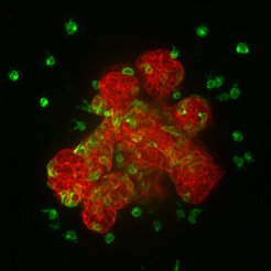 When the gene Twist1 turns on, it causes the cells to glow green and to migrate away from the mammary tissue.
