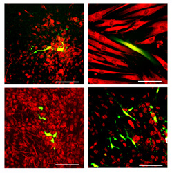 neural crest cells made from patients become four different cell types