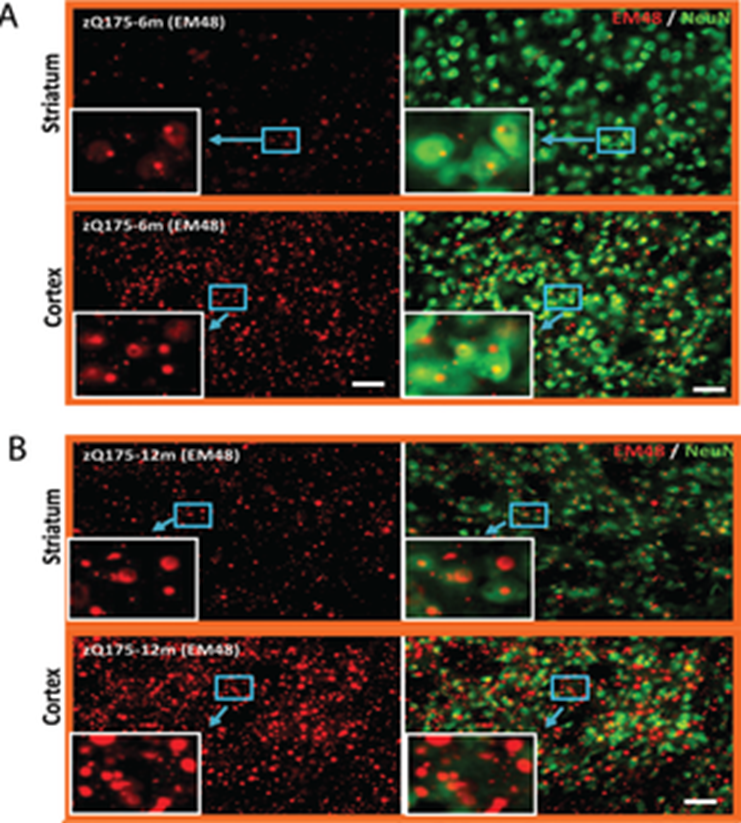 Immunofluorescent staining of Mutant huntingtin aggregates in zQ175 HD mouse brain
