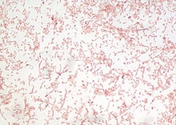 Gram stain of enterotoxigenic Bacteroides fragilis (ETBF) at 100x.  Courtesy of Dr. Shaoguang Wu, Johns Hopkins and Johns Hopkins Pathology Photo.