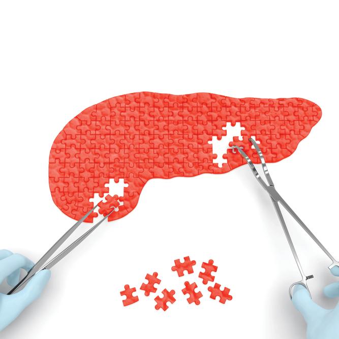 The graphic shows a puzzle in the shape of a pancreas. 