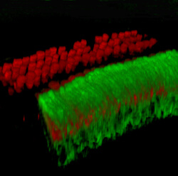 neat rows of outer hair cells are connected to less tidy nerve cells