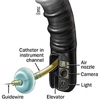 Side viewing endoscope.
