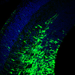 Brain cells engineered to produce fluorescent green Botch protein in the developing mouse cortex. Nuclei of cells are in blue.