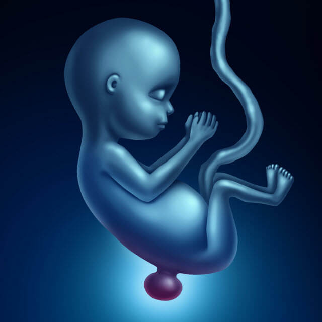 an illustration of a fetus with spina bifida