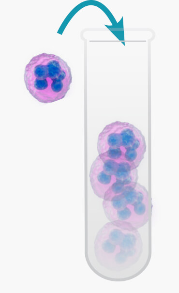 Collect immune cells from patient
