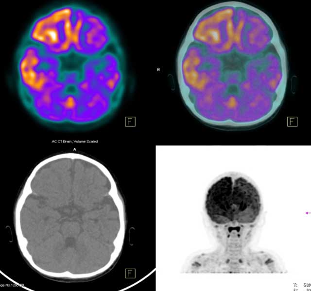 brain scan and x-ray images