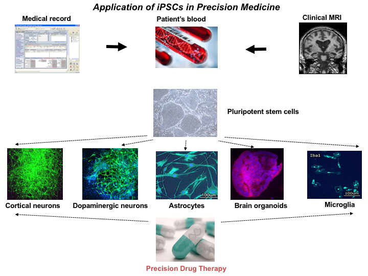 Application of iPSCs in Precision Medicine