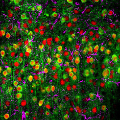 A two-photon microscopy image showing a calcium sensor (green), the nuclei of neurons (red) and supporting cells called astrocytes (magenta).