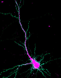  Researchers studied the movement of the protein SynGAP (green) within brain cells