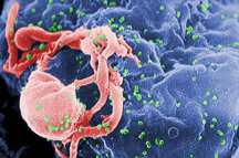HIV on a lymphocyte