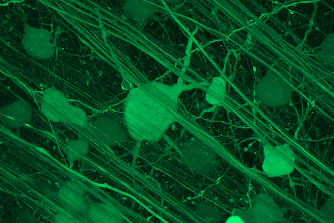 retinal ganglion cells image