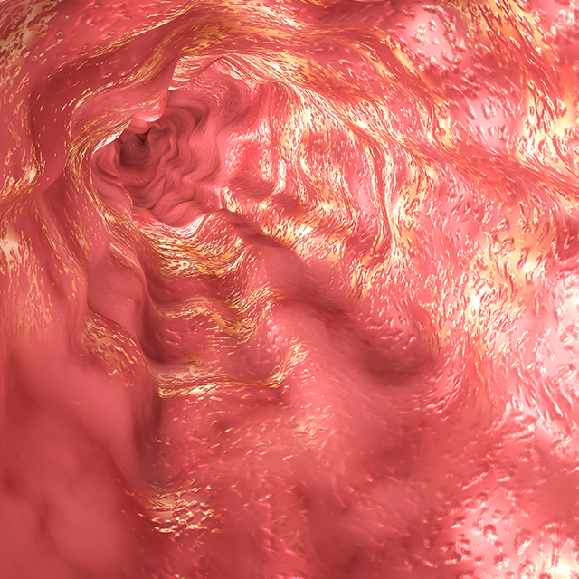 Image of Esophagus mucosa and esophageal sphincter