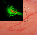 Real-time imaging of a rodent brain shows that nanoparticles coated with polyethylene-glycol (PEG) (green) penetrate farther within the brain than particles without the PEG coating (red).