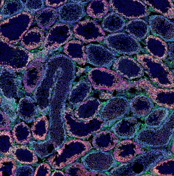 fluorescent image of tubules