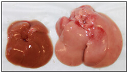 a small, normal liver next to an enlarged, fatty liver