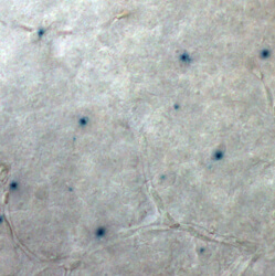 an image of retinal cells with little blue dots representing where neuropsin is
