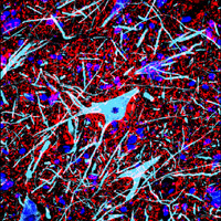 motor neuron image