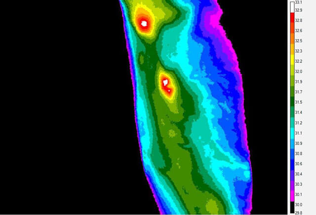 Infrared image of skin test