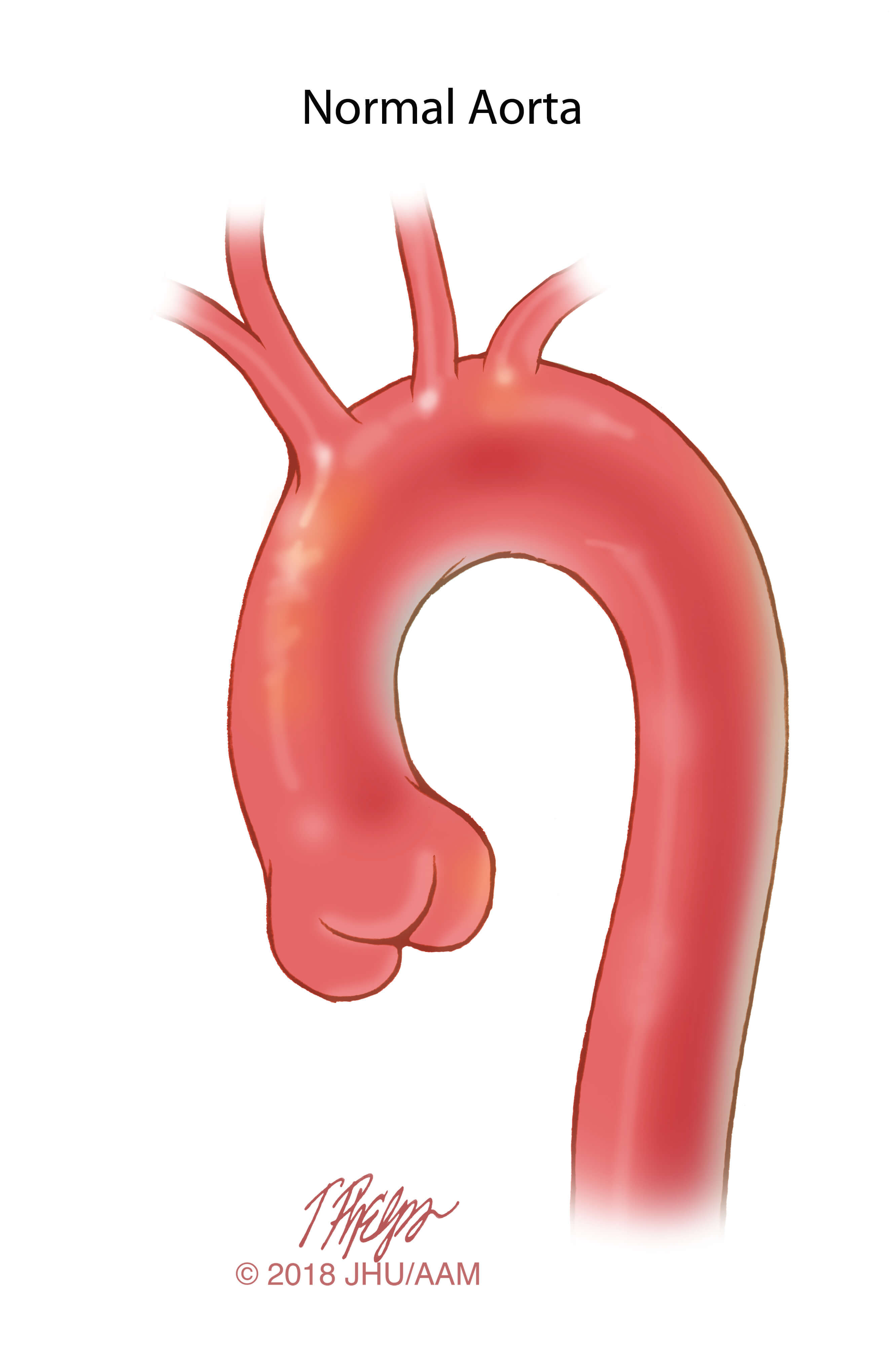 Normal Aorta