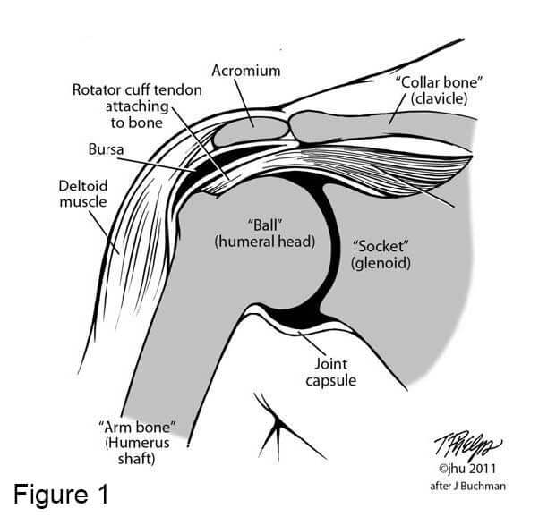 Shoulder diagram of a repaired rotator cuff tendon. Described under the heading Why am I still having symptoms after rotator cuff surgery?