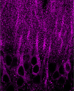 Phosphorylated GluR1receptors (dots) congregate around neuronal synapses