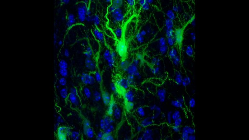 Newswise: In Mice: Transplanted Brain Stem Cells Survive Without Anti-Rejection Drugs