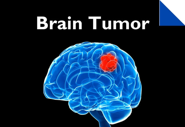 brain tumor promotional graphic