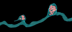 diagram of a retinal ganglion cell with bulges filled with mitochondria