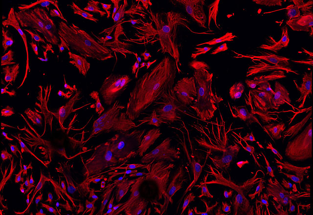 Müller cells, isolated from a human retina, stained with vimentin and DAPI. 