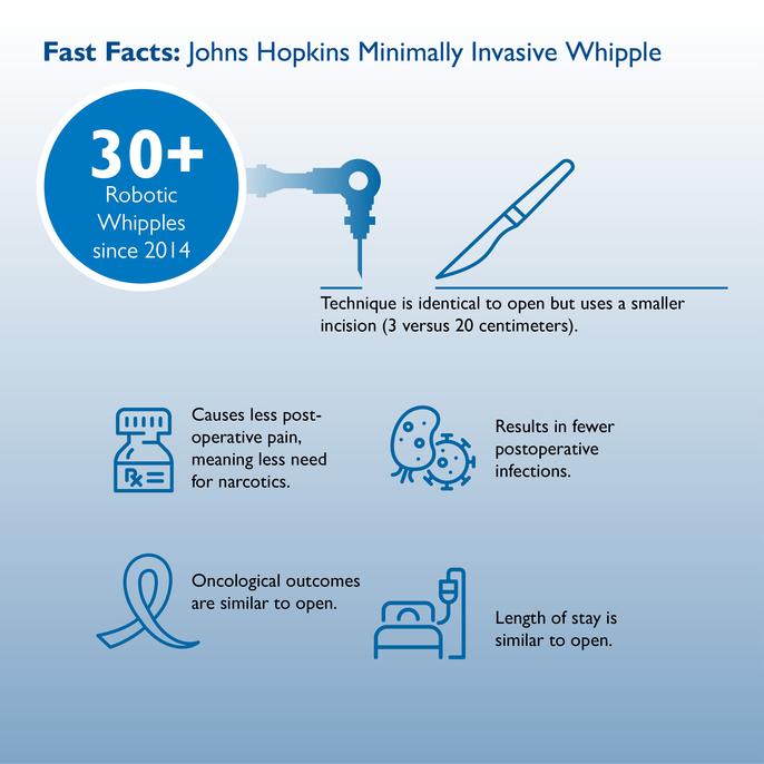 A graphic shows fast facts about the minimally invasive Whipple. 