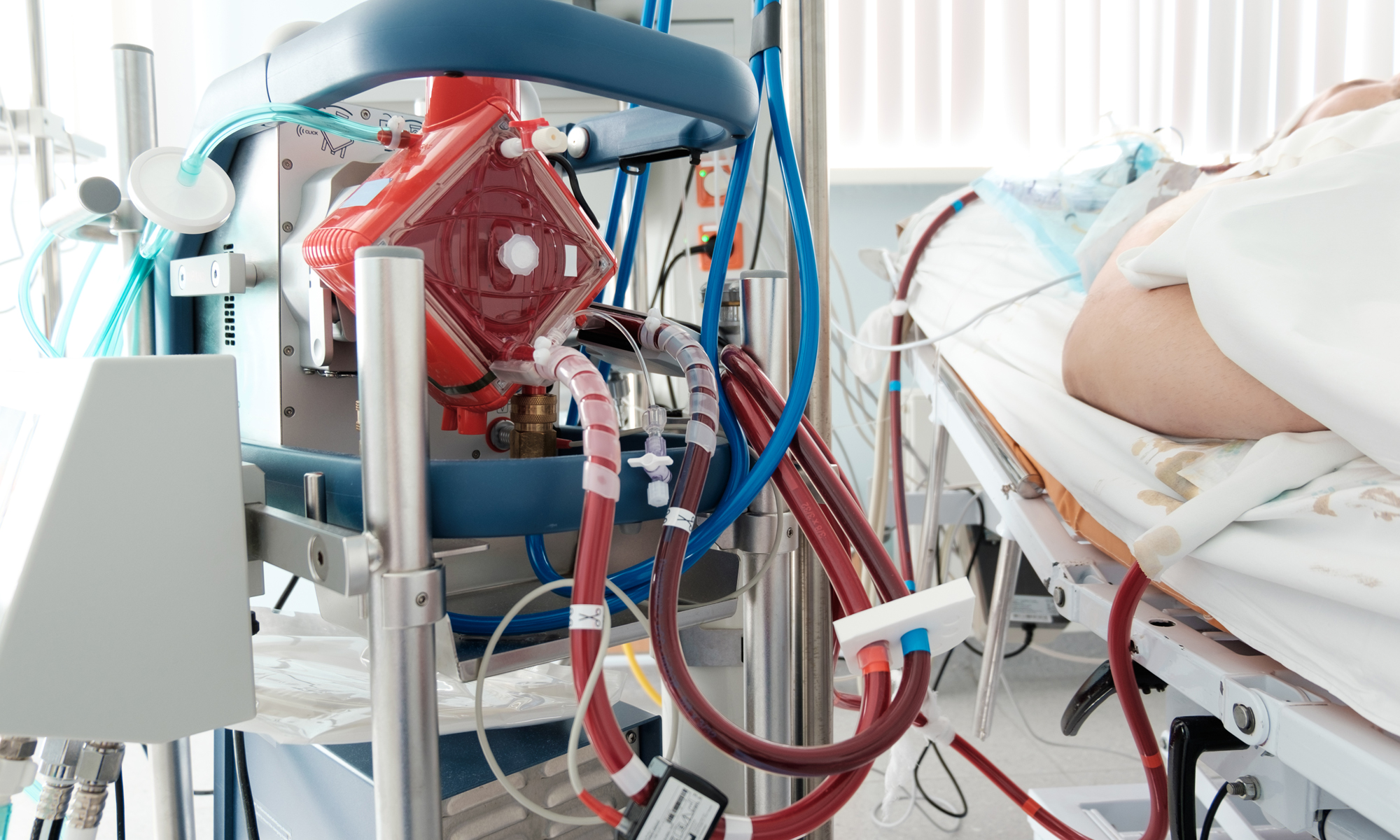 ECMO Team Approach Improves Odds for Critically Ill Patients
