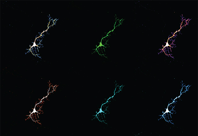 Brain Neuron collage