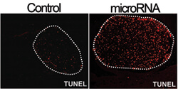 The red dots in these photos indicate cancer cells that are dying. The image on the left shows the amount of cell death in a control-treated tumor and, on the right, in a microRNA-treated tumor. Tumor sections were stained with TUNEL, a marker for cells undergoing programmed cell death.
