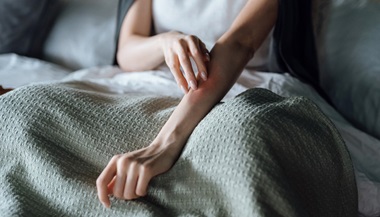 Woman scratching an itchy rash on her arm