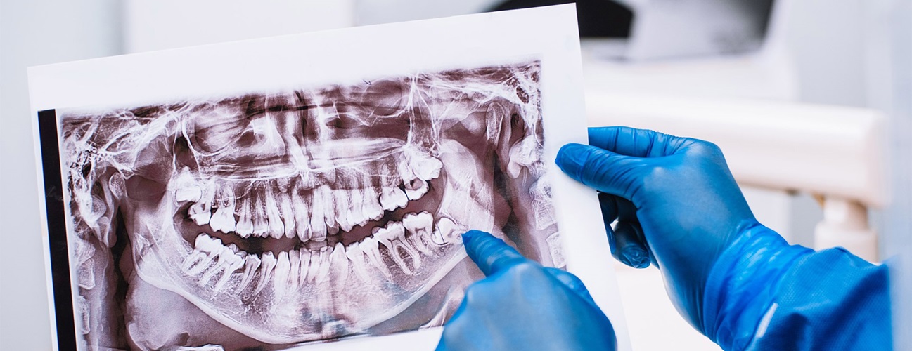 Dentist holding an x-ray of a patients teeth. 